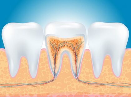 Лікування кореневих каналів зубів